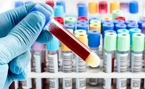 Clinical Chemistry